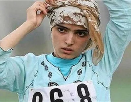روزنگار| ریحانه بهشتی،پس از مرگ مغزی، پنج عضو بدنش اهدا شد